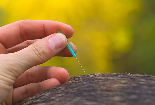 Déroulement d’une consultation en acupuncture