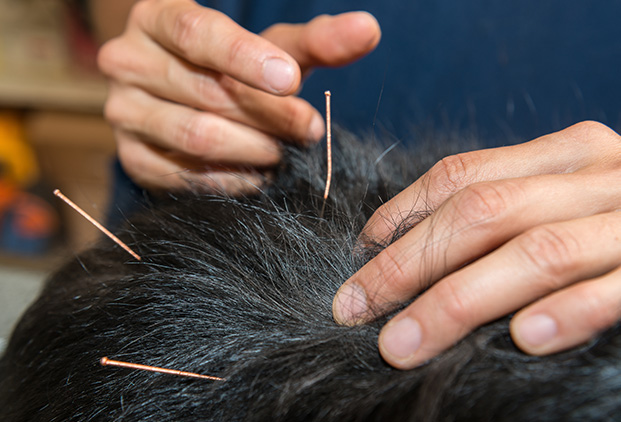 Qu’est-ce que l’électroacupuncture animale ?